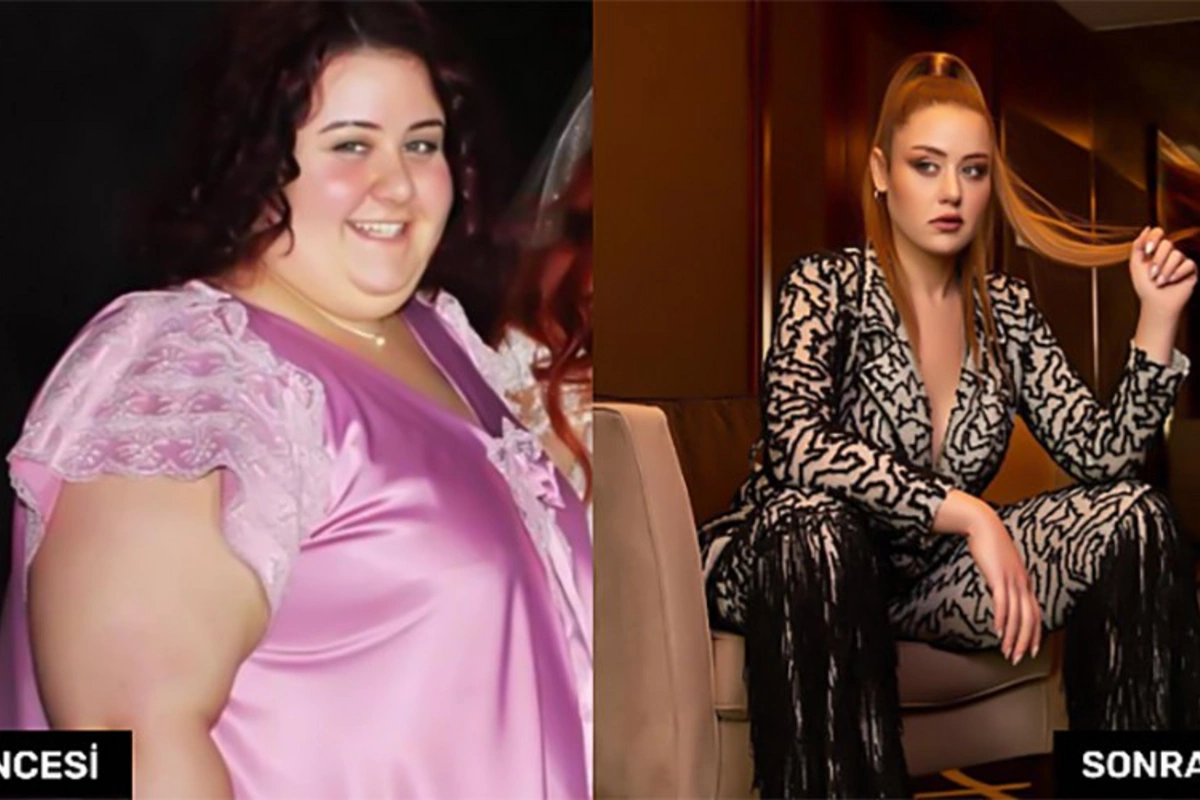 110 kiloqram arıqlayan aktrisanın SON HALI