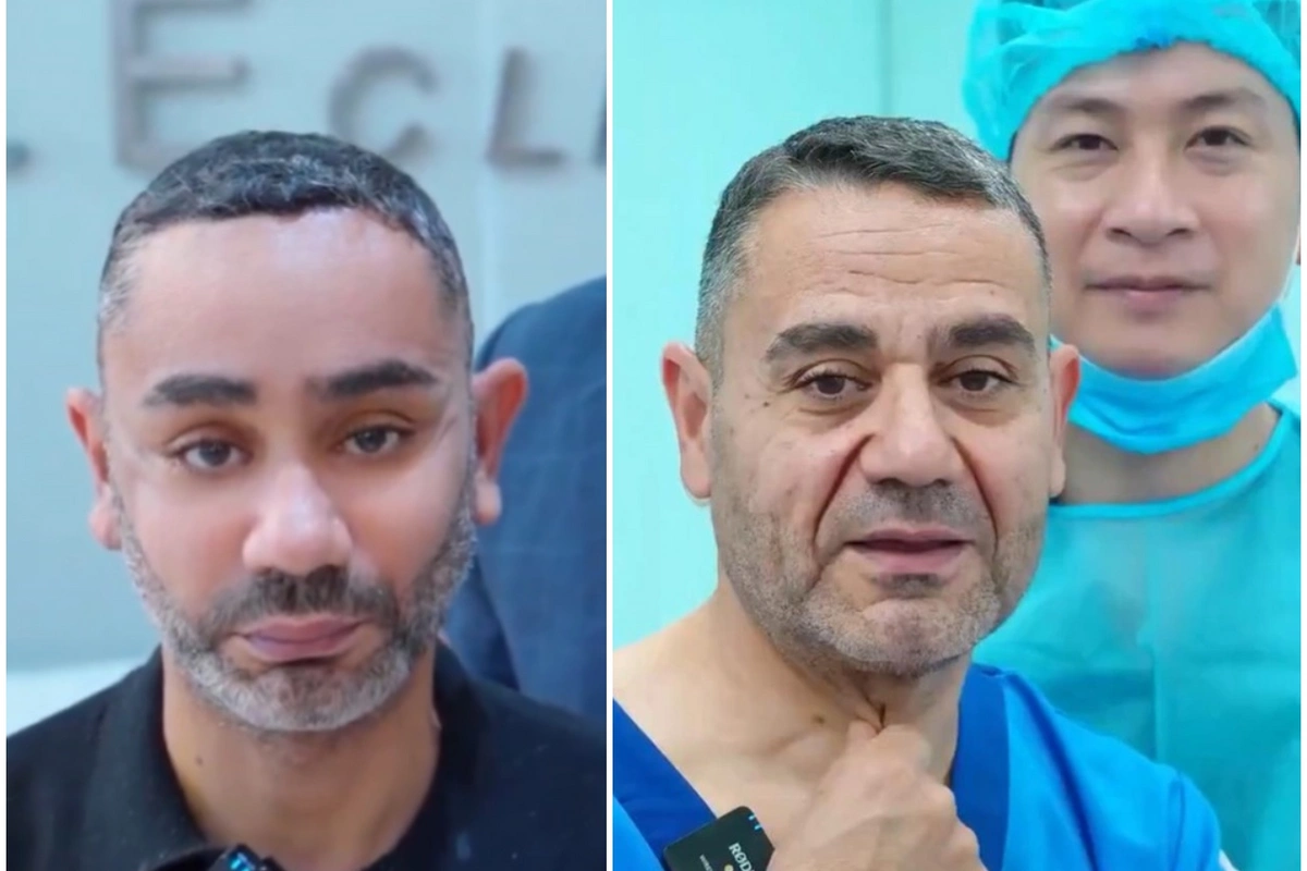 58 yaşlı kişi gəncləşmək üçün Viyetnama getdi, tanınmaz hala düşdü