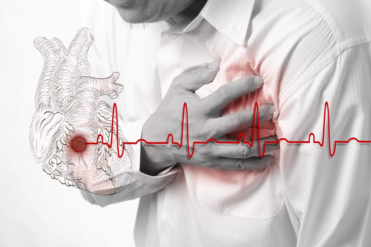 Alimlər qəfil ürək dayanması üçün əsas risk faktorlarını açıqladı
