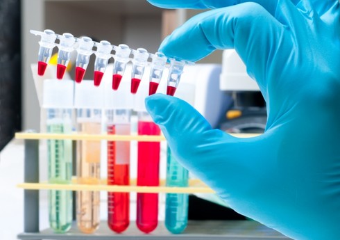 Azərbaycanın üç idmançısı antidopinq pozuntusuna görə cəzalandırılıb