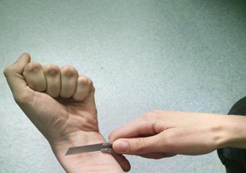 Bakıda 43 yaşlı kişi kəsici alətlə özünə çoxsaylı xəsarətlər yetirib