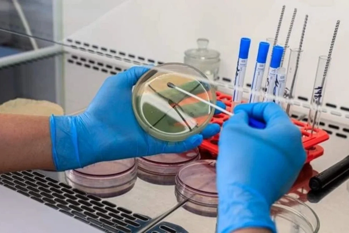 Bir sıra Avropa ölkəsi hantavirus riskinə qarşı hazırlıq görür