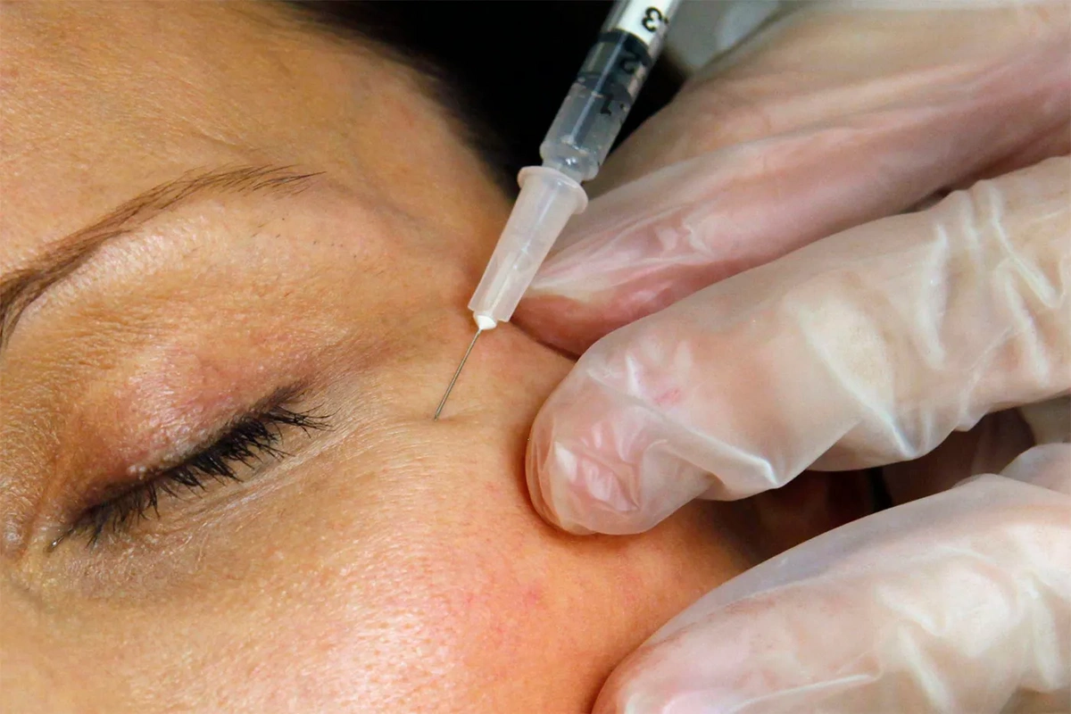 Botox və dolğu etdirənlərə RƏSMİ XƏBƏRDARLIQ
