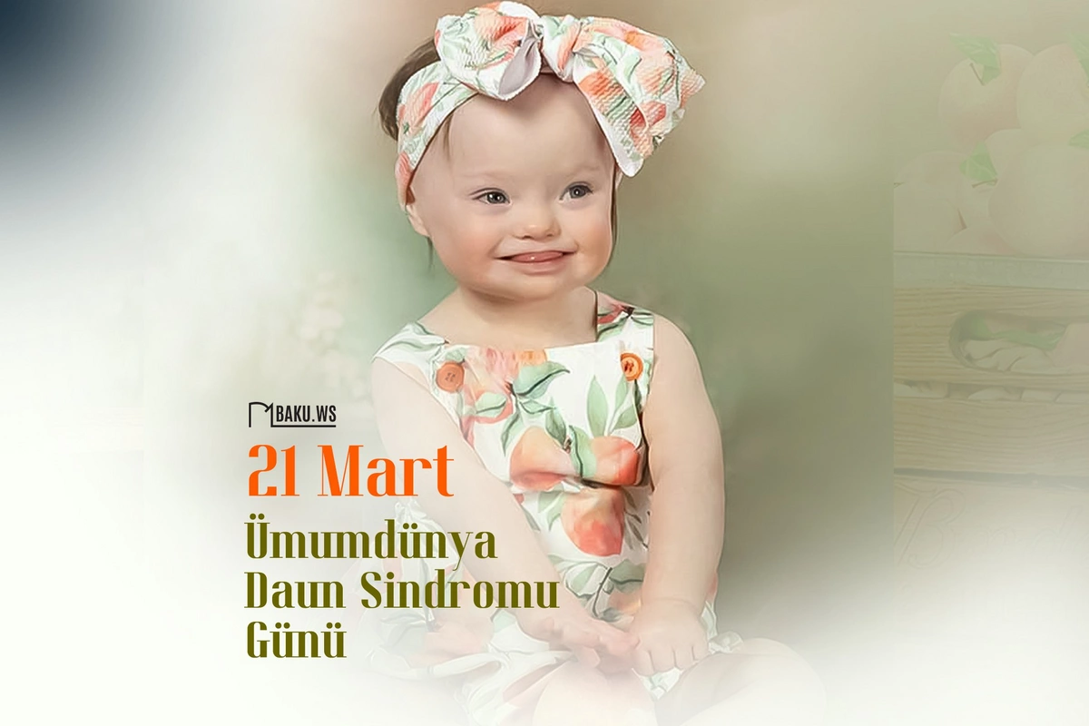 Bu gün Beynəlxalq Daun Sindromu Günüdür