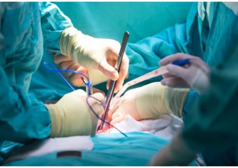 Böyrəyin transplantasiyası metodu ilə müalicə zərurətinin təcililik statusuna dair meyarlar müəyyənləşib