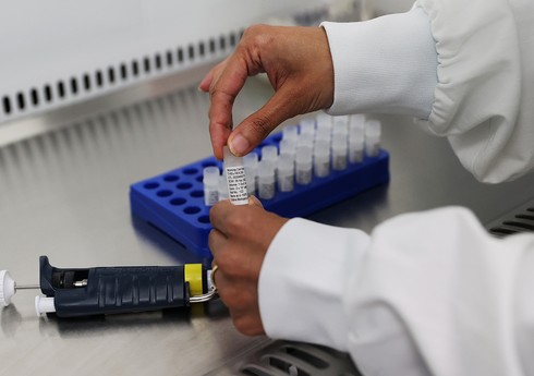 CAR İnstitutu: Metapnevmovirus insanlar üçün böyük təhlükə təşkil etmir