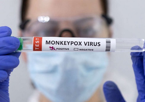 Dünyada meymunçiçəyinə yoluxma hallarının sayı 50 mini keçib