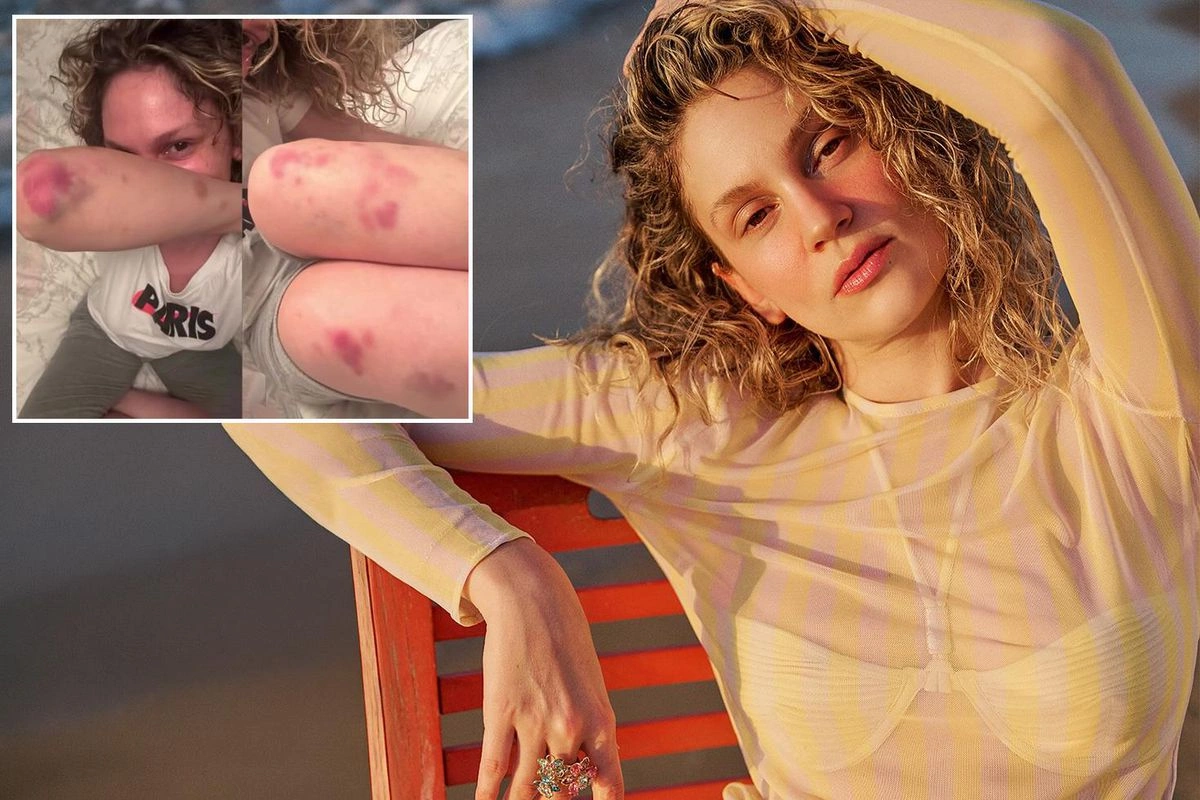 Farah Zeynep Abdullahın bu görüntüləri sevənlərini qorxutdu Farah Zeynep Abdullahın bu görüntüləri sevənlərini qorxutdu