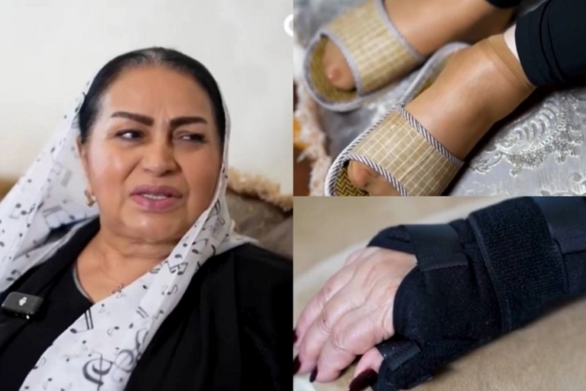 Firuzə İbadova yıxılıb, yeriyə bilmir Firuzə İbadova yıxılıb, yeriyə bilmir