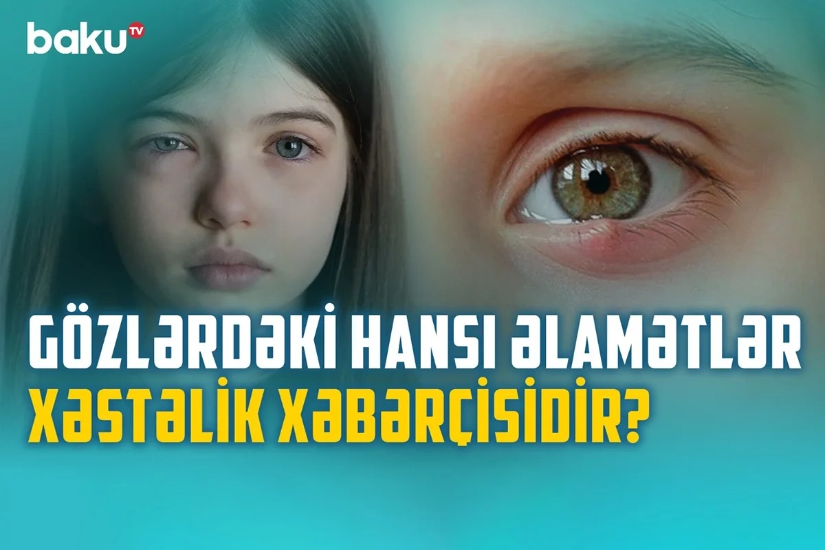 Gözlərimizin zəifləməməsi üçün nə etməli?