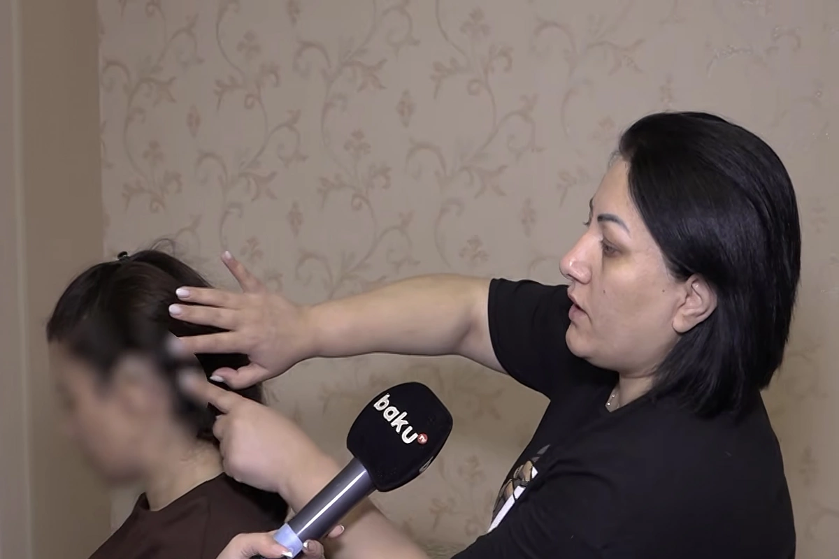 Həkim əməliyyatdan sonra tamponu xəstənin başında unutdu