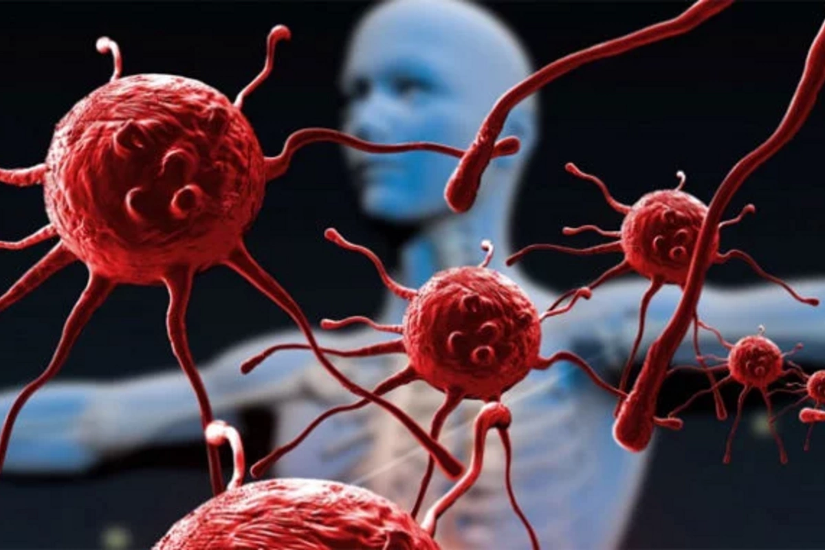 Hər il milyonlarla insanın öldüyü xəstəliklərin SİYAHISI Hər il milyonlarla insanın öldüyü xəstəliklərin SİYAHISI