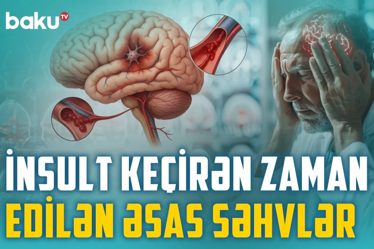 İnsult zamanı nəyi etmək, nəyi etməmək lazımdır? İnsult zamanı nəyi etmək, nəyi etməmək lazımdır?