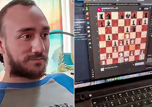 Mask: “Neuralink” çipli adam düşüncələrdən istifadə edərək “X”də paylaşım edib