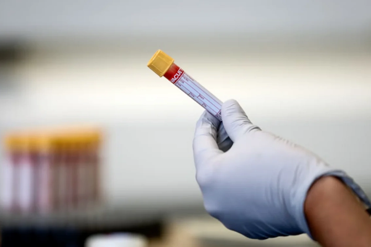 Nikahdan əvvəl narkotest tələbi və reallıqlar: Mütəxəssislər nə düşünürlər?