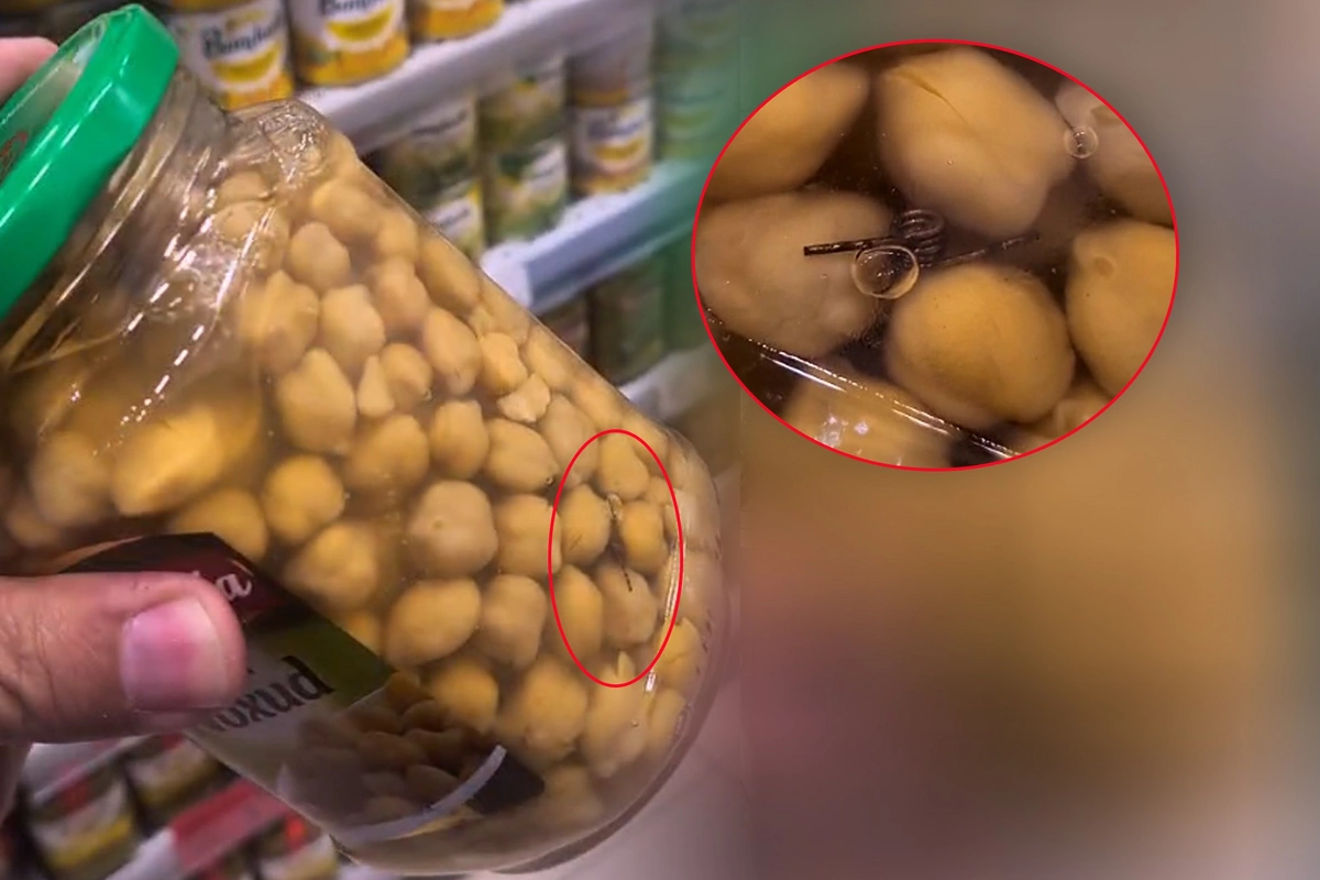 Noxudun içindən yad cisim çıxdı Noxudun içindən yad cisim çıxdı