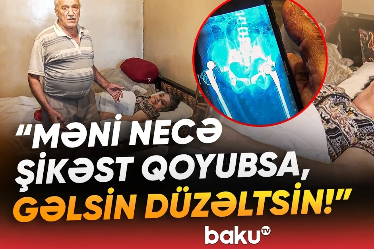 Qadının sol ayağının yerinə sağ ayağı əməliyyat edilib? - 