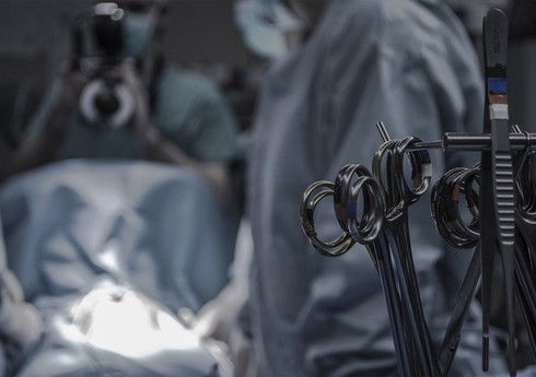 Robot cərrah sidik kisəsinin ilk transplantasiyasını həyata keçirəcək
