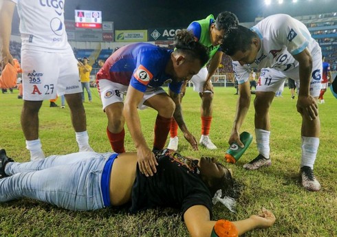 Salvadorda futbol stadionunda baş verən izdihamda 9 nəfər ölüb Salvadorda futbol stadionunda baş verən izdihamda 9 nəfər ölüb