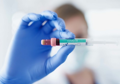 Son sutkada Azərbaycanda 256 nəfər koronavirusa yoluxub, 3 nəfər ölüb