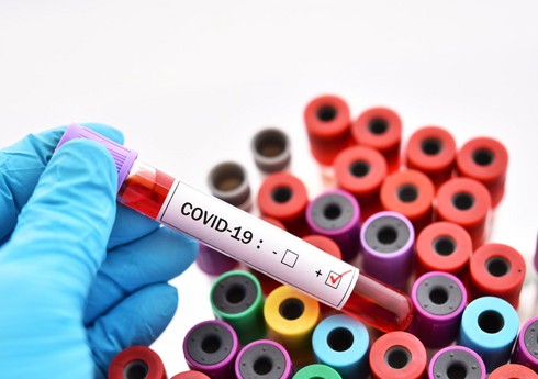 ÜST: “Dünya əhalisinin təxminən üçdə biri koronavirusa qarşı peyvənd olunmayıb” ÜST: “Dünya əhalisinin təxminən üçdə biri koronavirusa qarşı peyvənd olunmayıb”