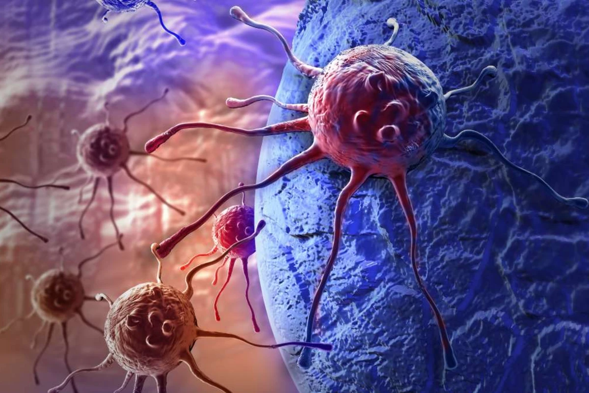 Süni intellekt süd vəzi xərçəngini 5 il əvvəlcədən proqnozlaşdıra bilər