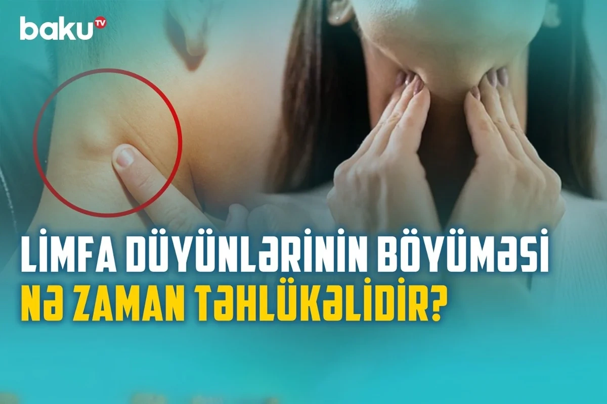 Xoşxassəli və bədxassəli limfa düyünlərinin əsas fərqləri: Həkim məsləhəti